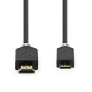 High-Speed-HDMI™-Kabel mit Ethernet |...